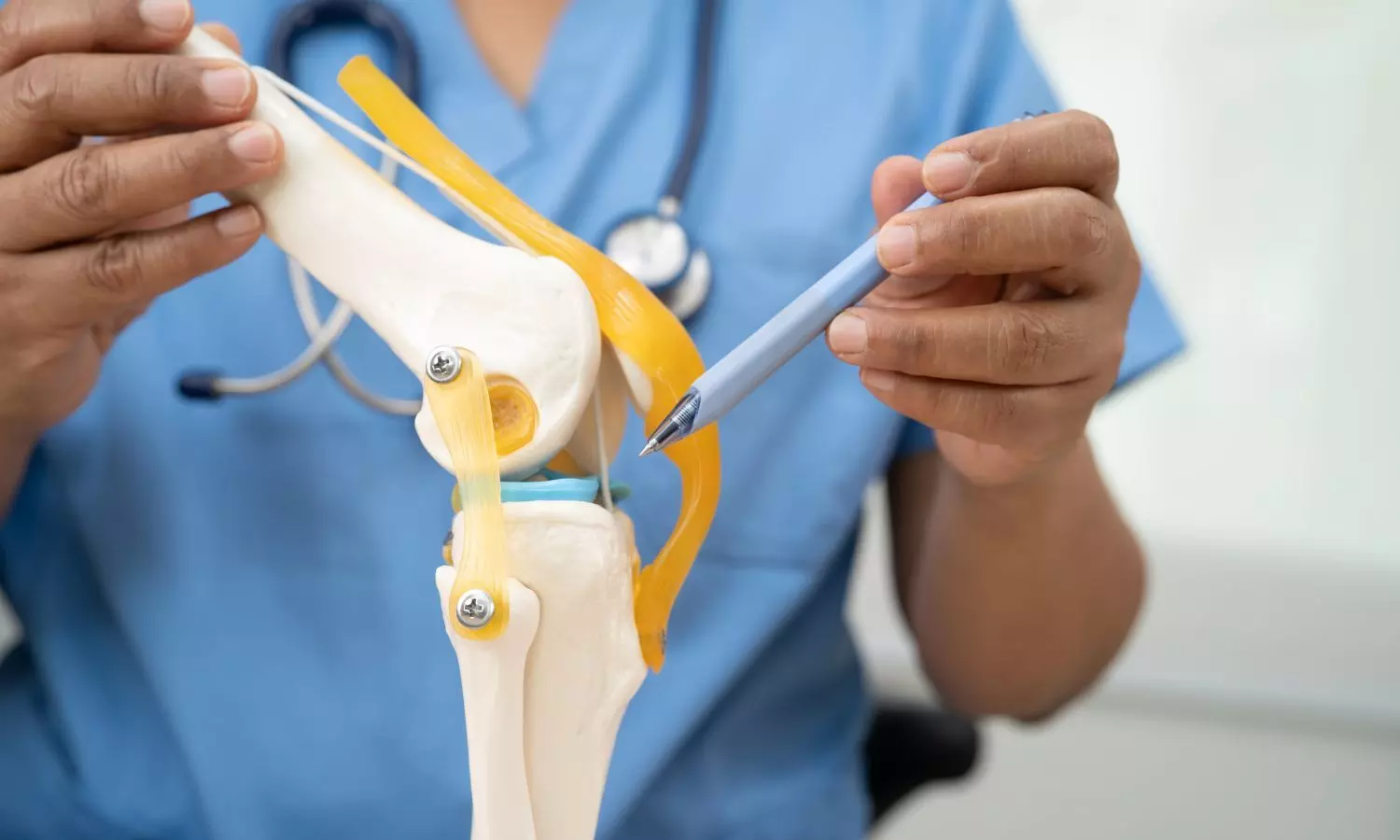  Total knee replacement Chandigarh