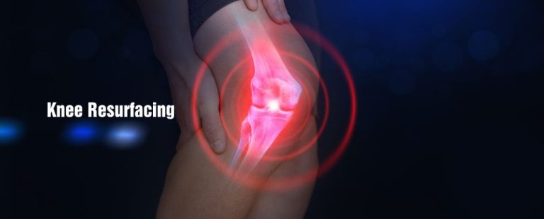 ft 3d knee resurfacing