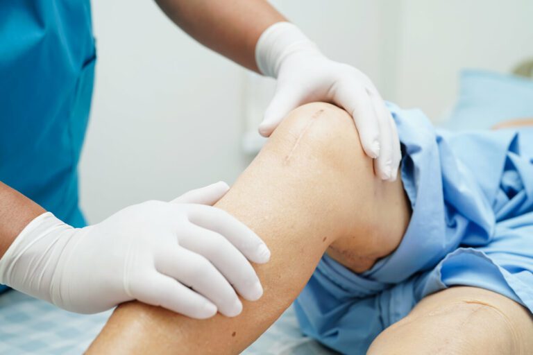 robolens ft 3d knee resurfacing