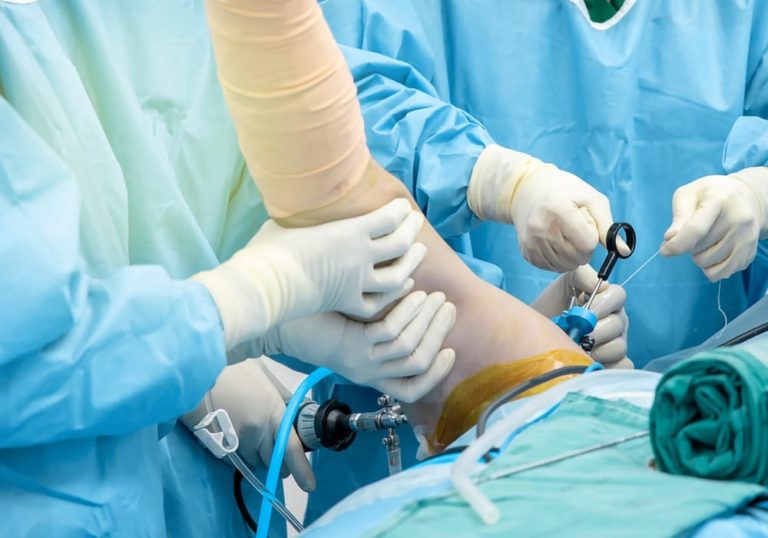 shoulder surgery Chandigarh